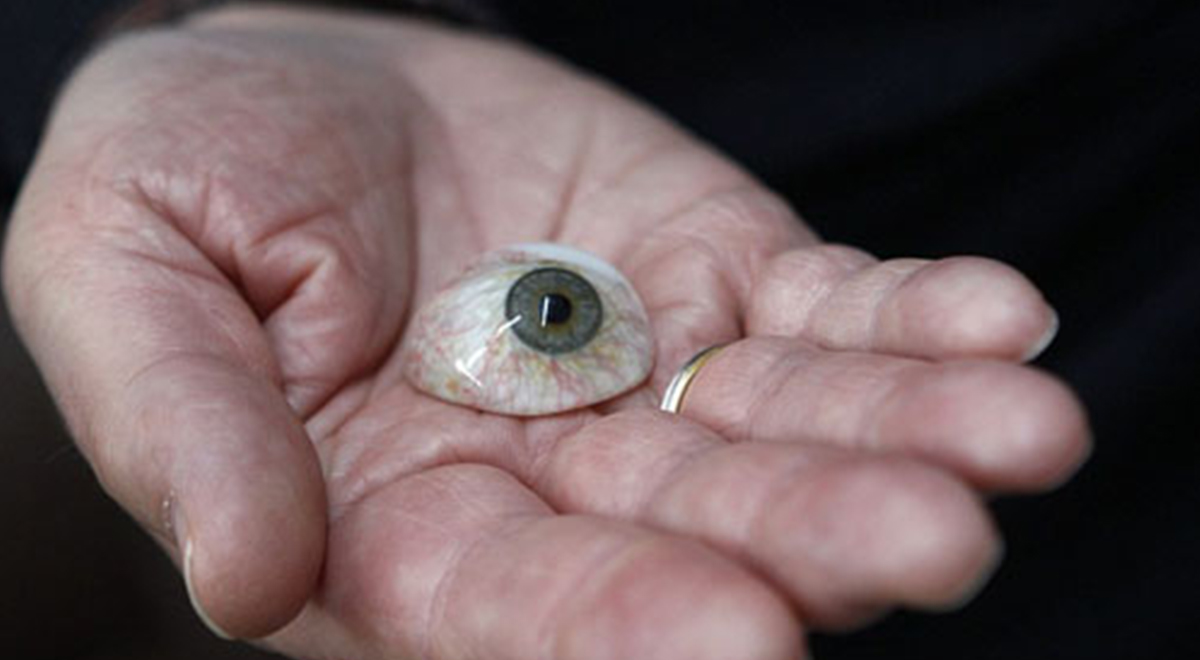 چشم شور چشم زخم