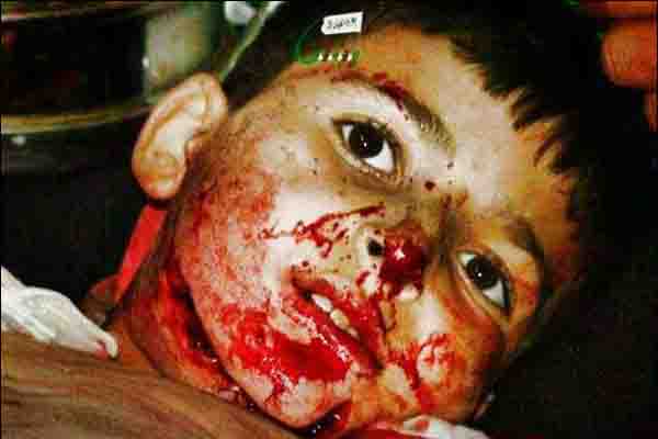 ذبح کودک شیعه ذبح کودک شیعه